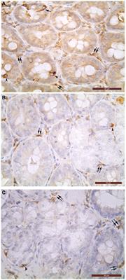 Glucagon- and insulin-immunopositive endocrine cells in porcine extrahepatic bile ducts and gallbladder